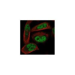 ADAL Rabbit anti-Human, Polyclonal, Novus Biologicals 25 &mu;g; Unconjugated:Antibodies,