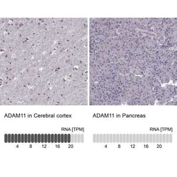 ADAM11 Antibody, Novus Biologicals 100 &mu;g; Unconjugated:Antibodies,