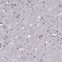 ADAM11 Antibody, Novus Biologicals 100 &mu;g; Unconjugated:Antibodies,