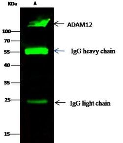 ADAM12 Rabbit anti-Human, Clone: 737, Novus Biologicals 50 &mu;g; Unconjugated:Antibodies,