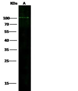 ADAM12 Rabbit anti-Human, Clone: 737, Novus Biologicals 50 &mu;g; Unconjugated:Antibodies,