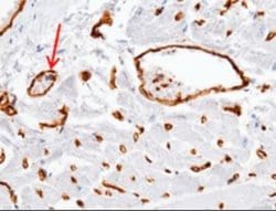 ADAM15 Rabbit anti-Human, Clone: 7, Novus Biologicals 50 &mu;g; Unconjugated:Antibodies,