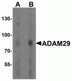 ADAM29 Antibody - BSA Free, Novus Biologicals 0.1 mg | Buy Online | Novus Biologicals | Fisher Scientific
