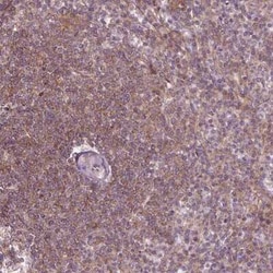 ADAM33 Antibody, Novus Biologicals 25 &mu;L, Unconjugated:Antibodies, Polyclonal
