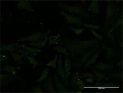 ADAMTS1 Antibody (1B8), Novus Biologicals 0.1 mg | Buy Online | Novus Biologicals | Fisher Scientific