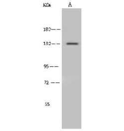 ADAMTS10 Antibody, Novus Biologicals:Antibodies:Primary Antibodies