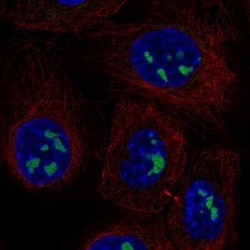 ADAMTS12 Antibody, Novus Biologicals 25ul; Unconjugated:Antibodies, Polyclonal
