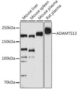 ADAMTS13 Rabbit anti-Human, Mouse, Rat, Clone: 7B2Z8, Novus Biologicals