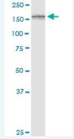 ADAMTS3 Antibody (1H8), Novus Biologicals 100 &mu;g | Buy Online | Novus Biologicals | Fisher Scientific