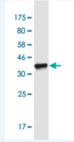 ADAMTS3 Antibody (1H8), Novus Biologicals 100 &mu;g | Buy Online | Novus Biologicals | Fisher Scientific