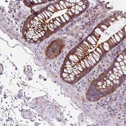 ADAMTSL2 Antibody, Novus Biologicals 25 &mu;L, Unconjugated:Antibodies,