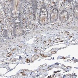 ADAMTSL3 Antibody, Novus Biologicals:Antibodies:Primary Antibodies