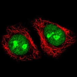 ADAR Antibody (CL0176), Novus Biologicals 100 &mu;g; Unconjugated:Antibodies,