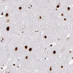 ADAR Antibody (CL0176), Novus Biologicals 100 &mu;g; Unconjugated:Antibodies,