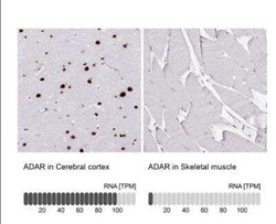 ADAR Antibody (CL0176), Novus Biologicals 100 &mu;g; Unconjugated:Antibodies,