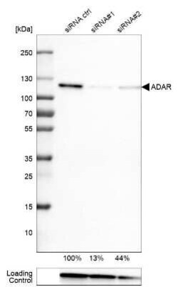 ADAR Antibody (CL0176), Novus Biologicals 100 &mu;g; Unconjugated:Antibodies,
