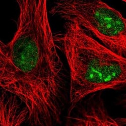 ADAR Antibody, Novus Biologicals 100 &mu;g; Unconjugated:Antibodies, Polyclonal