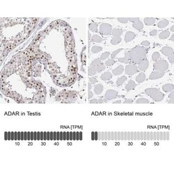 ADAR Antibody, Novus Biologicals 100 &mu;g; Unconjugated:Antibodies, Polyclonal