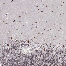 ADAR Antibody, Novus Biologicals 100 &mu;g; Unconjugated:Antibodies, Polyclonal