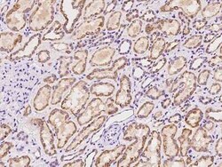 ADAT1 Antibody, Novus Biologicals 100 &mu;g, Unconjugated:Antibodies, Polyclonal