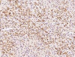 ADAT3 Antibody, Novus Biologicals 100 &mu;g; Unconjugated:Antibodies, Polyclonal