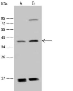 ADAT3 Antibody, Novus Biologicals 100 &mu;g; Unconjugated:Antibodies, Polyclonal