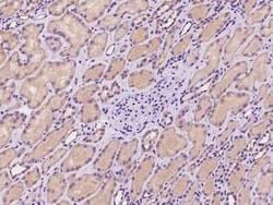 ADCK4 Antibody, Novus Biologicals 50 &mu;g | Buy Online | Novus Biologicals | Fisher Scientific