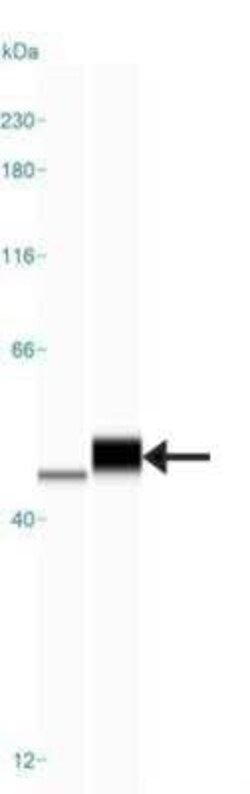 ADE2 Antibody, Novus Biologicals 0.1 mL; Unconjugated:Antikörper
