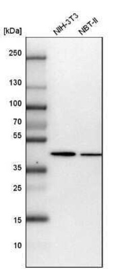 ADE2 Antibody, Novus Biologicals 0.1 mL; Unconjugated:Antikörper