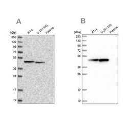 ADE2 Antibody, Novus Biologicals 0.1 mL; Unconjugated:Antikörper