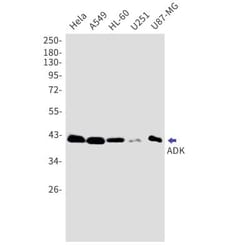 ADK Antibody (S05-0G0), Novus Biologicals 50 &mu;g; Unconjugated:Antibodies,