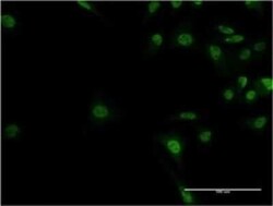 ADNP Antibody (2C5), Novus Biologicals 0.1 mg | Buy Online | Novus Biologicals | Fisher Scientific