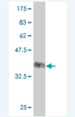 ADNP Antibody (6B8), Novus Biologicals 100 &mu;g | Buy Online | Novus Biologicals | Fisher Scientific