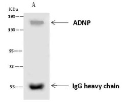 ADNP Antibody, Novus Biologicals 50 &mu;g, Unconjugated:Antibodies, Polyclonal