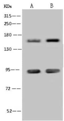 ADNP Antibody, Novus Biologicals 50 &mu;g, Unconjugated:Antibodies, Polyclonal