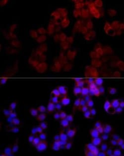 ADP-Sugar Pyrophosphatase/NUDT5 Rabbit anti-Human, Mouse, Rat, Clone: 7Y9M2,