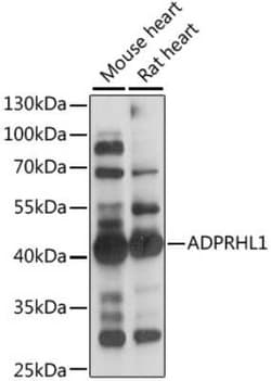 ADPRHL1 Antibody - Azide and BSA Free, Novus Biologicals:Antibodies:Primary