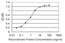 ADRM1 Antibody (3D11), Novus Biologicals 0.1 mg | Buy Online | Novus Biologicals | Fisher Scientific