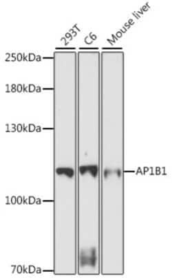 ADTB1 Antibody - Azide and BSA Free, Novus Biologicals 0.02 mL | Buy Online | Novus Biologicals | Fisher Scientific
