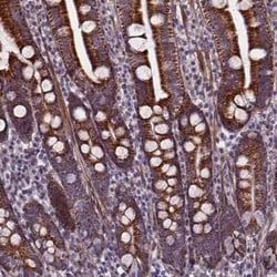 AE Binding Protein 1/ACLP Antibody, Novus Biologicals 25 &mu;L, Unconjugated:Antibodies,