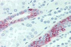 AE2 Antibody, Novus Biologicals 50 &mu;g; Unconjugated:Antibodies, Polyclonal