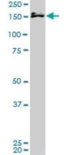 AF10 Antibody (2B9), Novus Biologicals 0.1 mg | Buy Online | Novus Biologicals | Fisher Scientific