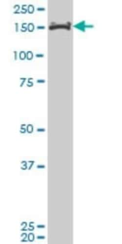 AF10 Antibody (2B9), Novus Biologicals 0.1 mg | Buy Online | Novus Biologicals | Fisher Scientific