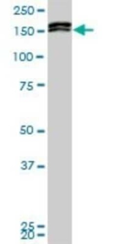 AF10 Antibody (6H8), Novus Biologicals 0.1 mg | Buy Online | Novus Biologicals | Fisher Scientific