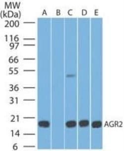 AG-2/AGR2 Antibody (10E2) - Azide and BSA Free, Novus Biologicals 0.1 mg;