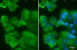 AG-2/AGR2 Antibody (HL1024), Novus Biologicals 100 &mu;g; Unconjugated:Antibodies,