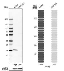 AG-2/AGR2 Antibody, Novus Biologicals:Antikörper:Primärantikörper