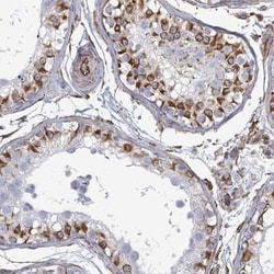 AGAP1 Antibody, Novus Biologicals:Antibodies:Primary Antibodies