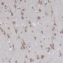 AGAP2 Rabbit anti-Human, Polyclonal, Novus Biologicals 100 &mu;g; Unconjugated:Antibodies,