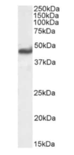 AGER Rabbit anti-Human, Clone: 2A11, Novus Biologicals 0.2 mg; Unconjugated:Antibodies,